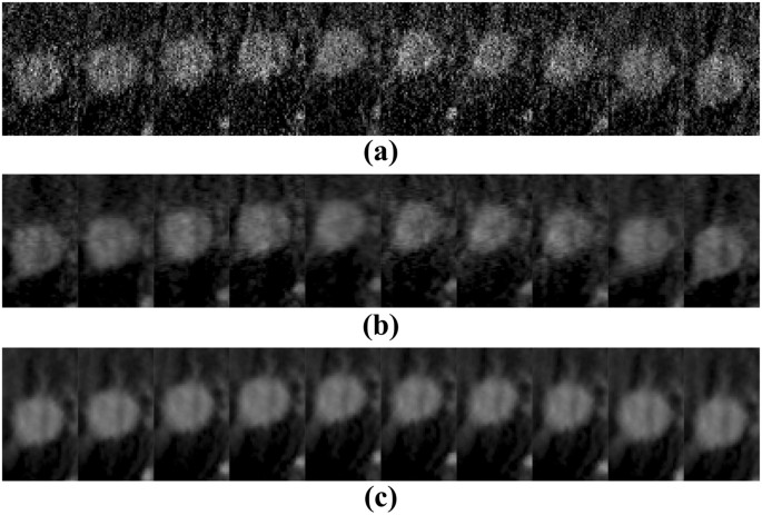 figure 17