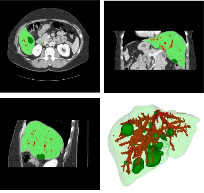 figure 11