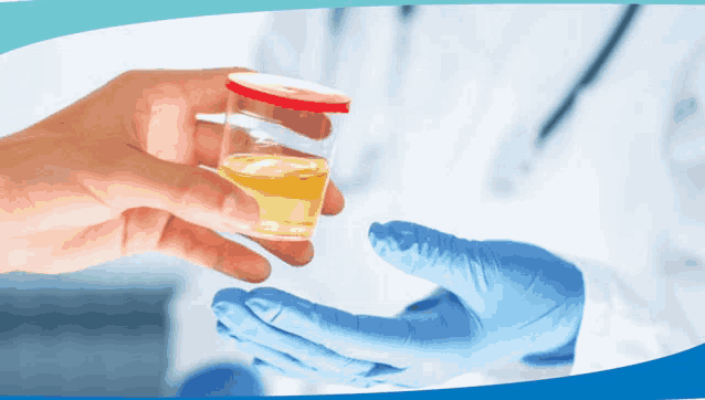 a person in blue gloves holds a jar of urine in their hand