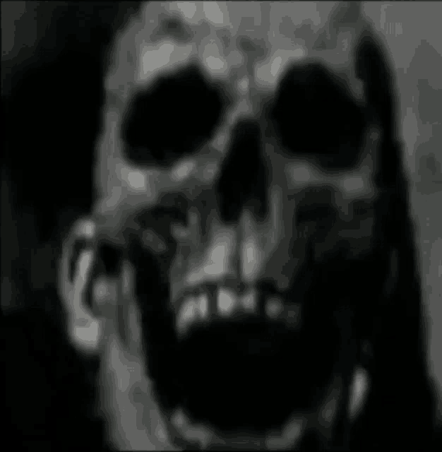 a black and white photo of a skull with its mouth open and teeth missing .