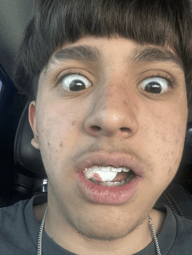 a young man with braces on his teeth looks at the camera