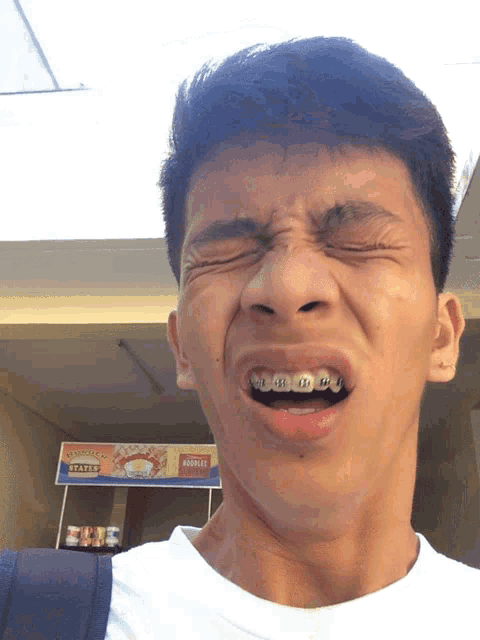 a young man with braces on his teeth making a funny face in front of a sign that says states