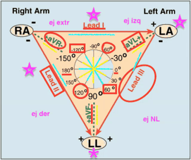 a diagram showing the leads of the right and left arm