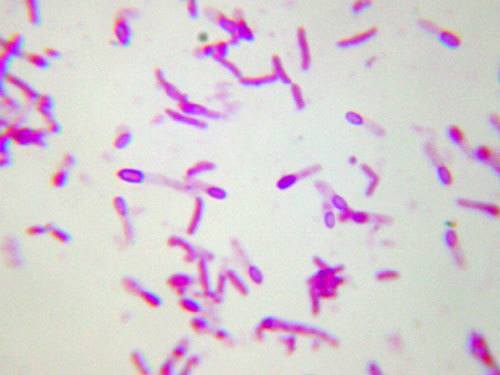 Endospore Staining: Principle, Procedure and Results - Learn