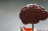 A model of a brain on a metal stand