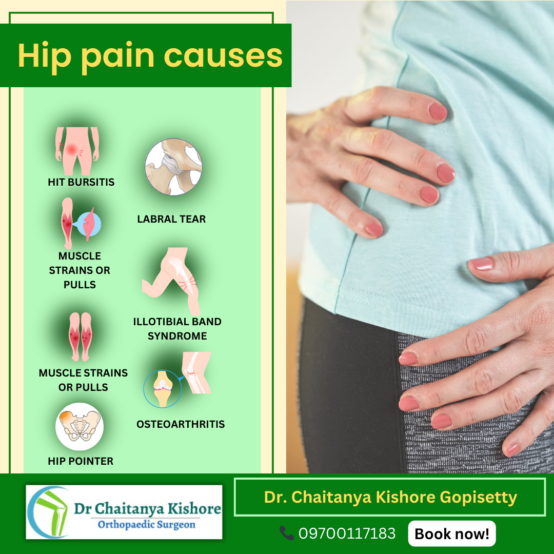 Cause of Hip Pain. Hip pain can be a debilitating… | by ...