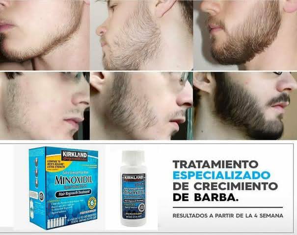 COMO USAR MINOXIDIL NA BARBA → Passo a Passo e Dicas