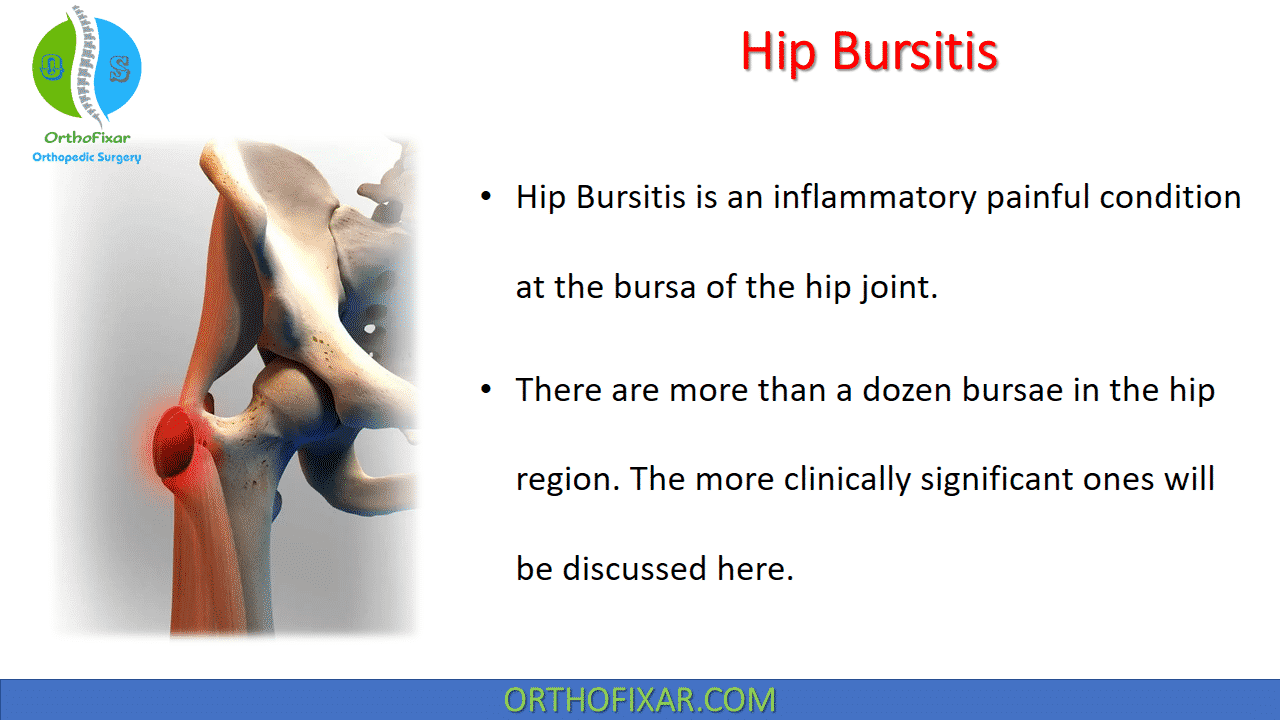 Trochanteric Bursitis - Bút Chì Xanh