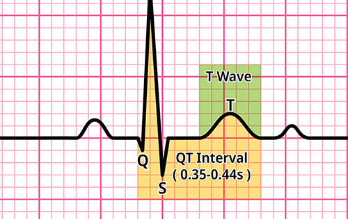 Is QT the Best Metric for Detecting Cardiac Risk in Patients Taking Antipsychotics?