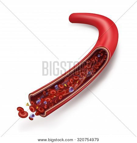 Normal Blood Flow In The Vein. Blood Cells (white Blood Cells, Red Blood Cells, Platelets In Plasma)