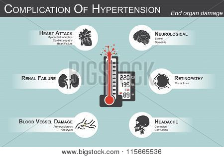 Complication Of Hypertension