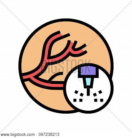 Removal Of Vascular Pathologies Color Icon Vector. Removal Of Vascular Pathologies Sign. Isolated Sy