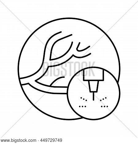 Removal Of Vascular Pathologies Line Icon Vector. Removal Of Vascular Pathologies Sign. Isolated Con