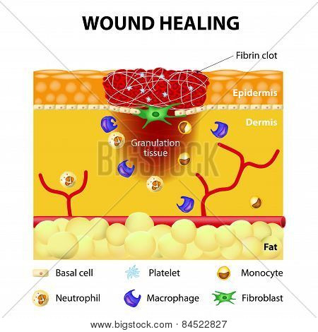 Process Of Wound Healing