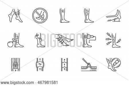 Varicose Treatment Icons, Leg Veins Thrombosis Disease And Surgery Vector Symbols. Varicose Or Legs 