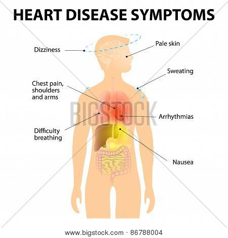 Heart Disease Symptoms