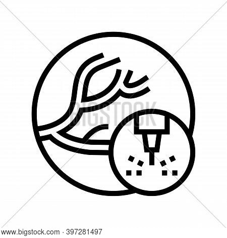 Removal Of Vascular Pathologies Line Icon Vector. Removal Of Vascular Pathologies Sign. Isolated Con