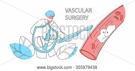 Vector Apartment Abstract Vascular Surgeon Who Performs Operation To Remove Blood Thrombus From Vess